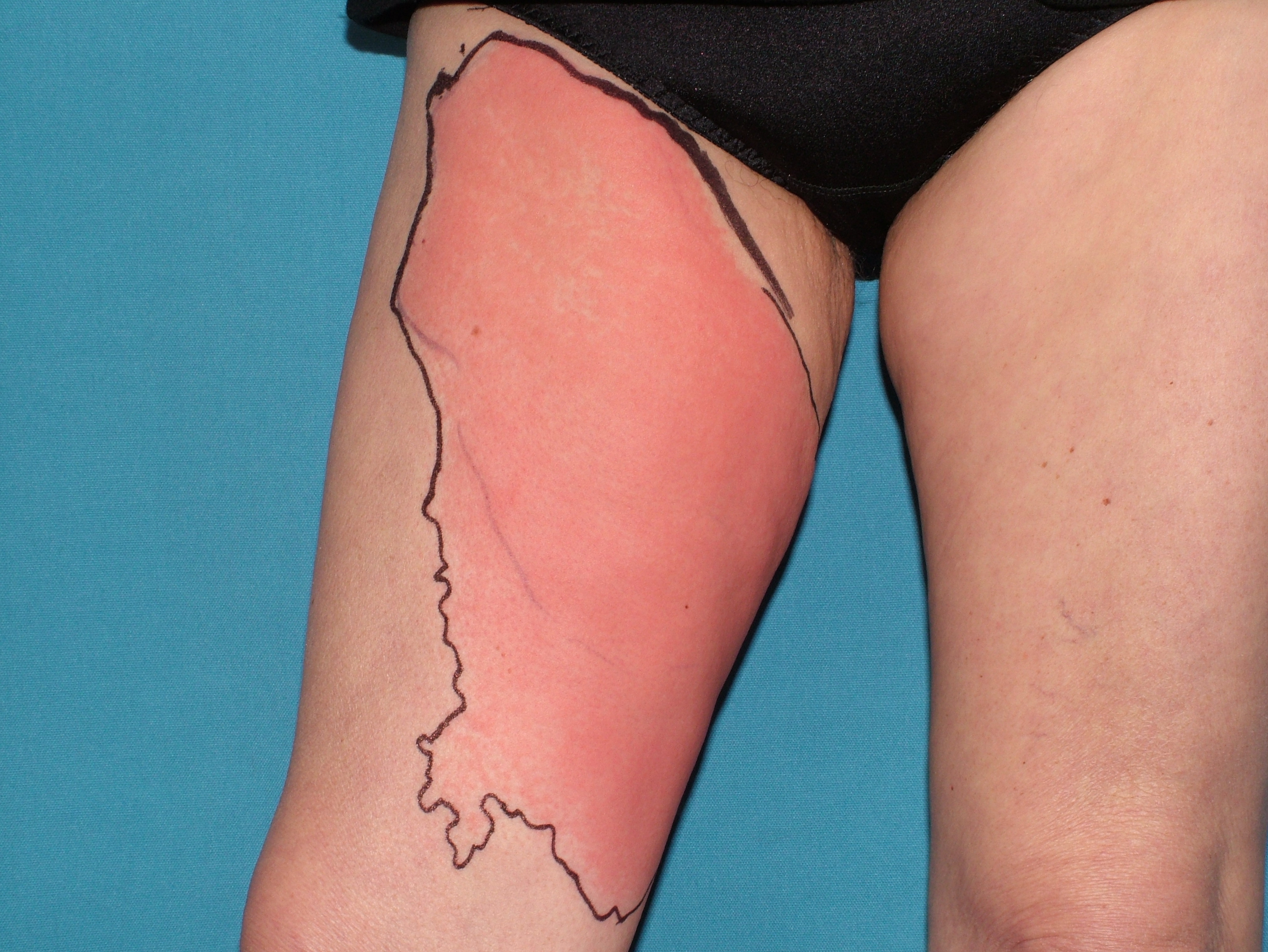 Rus ayol nazoratsiz porno video