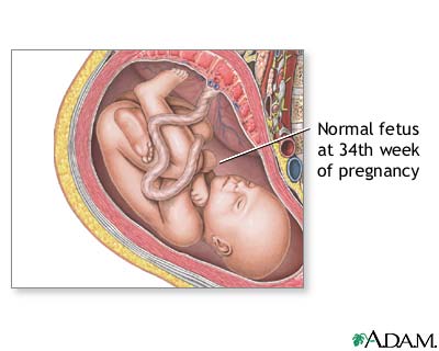 34 Week Old Fetus